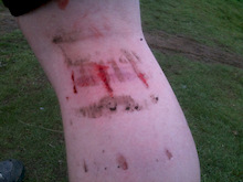 superstar pedals putting a mini monster energy logo in my leg...