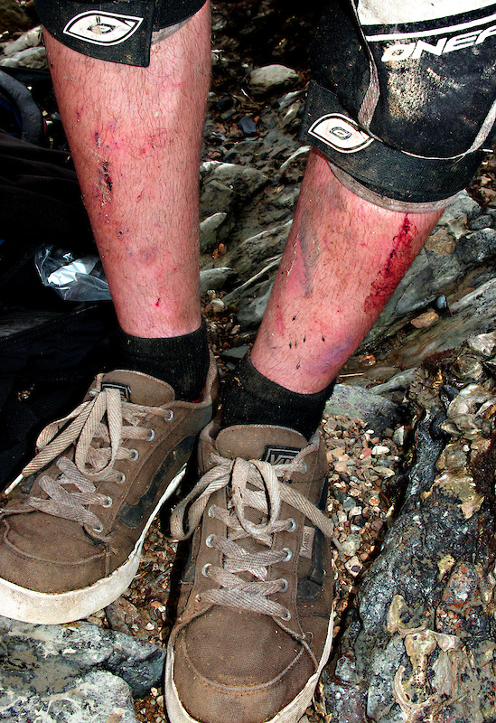 Riding flats, my shins were macerated. Photo: Rob Metz