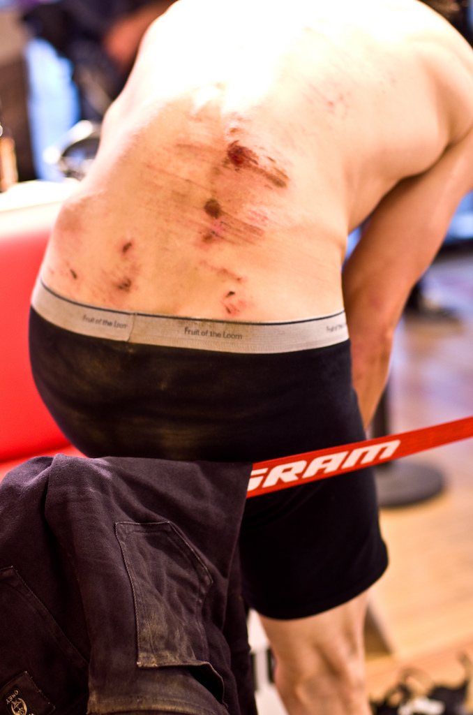 Looks tough with all those bones sticking out. Imagine what his body feels like when he hits 25 or even 30 years old.